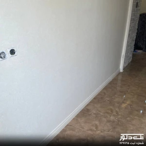 لمینت قرنیز agt (12).jpg